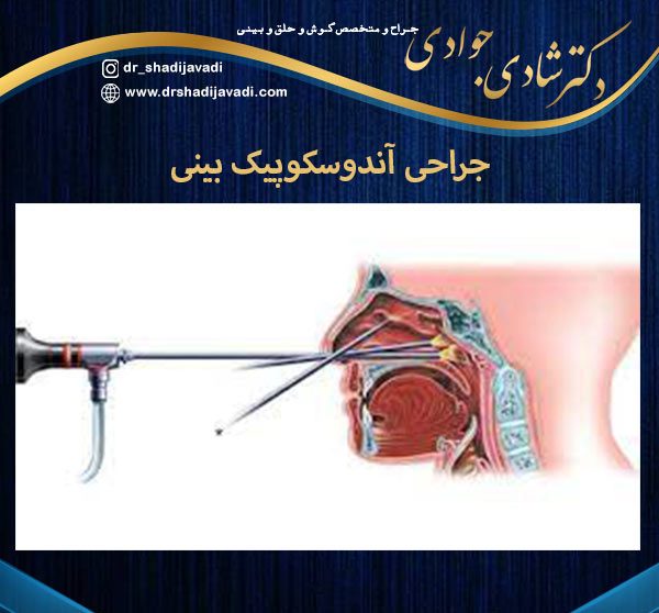 جراحی آندوسکوپیک بینی