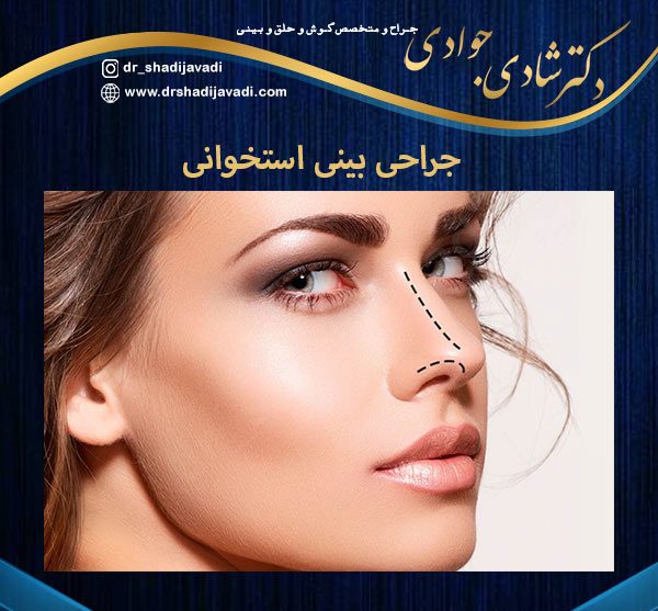 جراحی بینی استخوانی - دکتر شادی جوادی