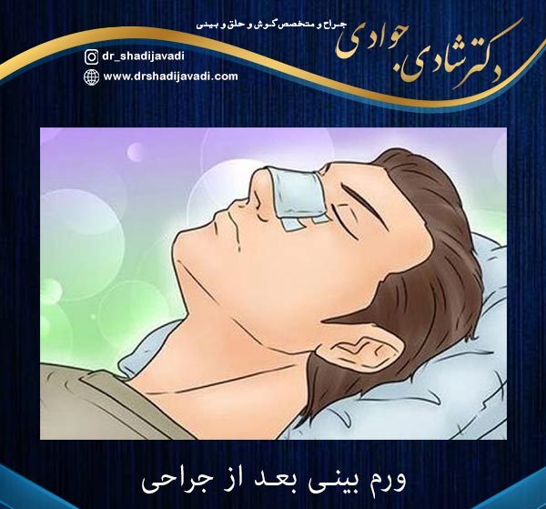 ورم بینی بعد ار جراحی - دکتر شادی جوادی