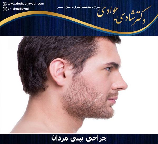 جراحی بینی مردان - دکتر شادی جوادی