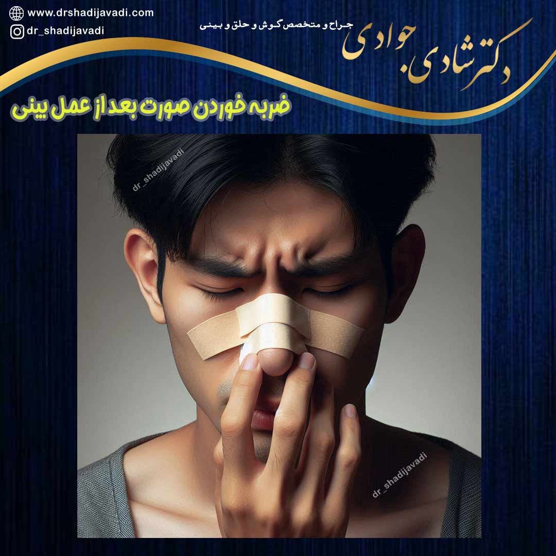 ضربه خوردن بینی بعد از عمل - دکتر شادی جوادی