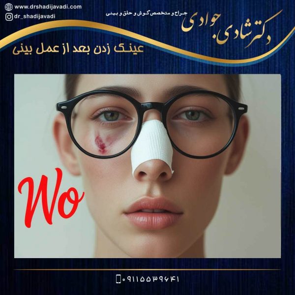 عینک زدن بعد از عمل بینی