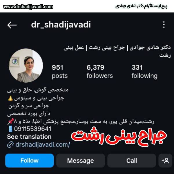 عکس جراح بینی رشت - دکتر شادی جوادی