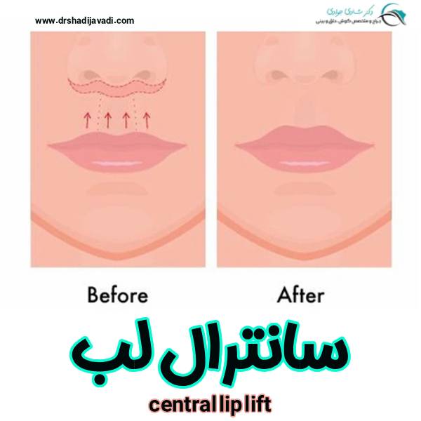 سانترال لب - دکتر شادی جوادی