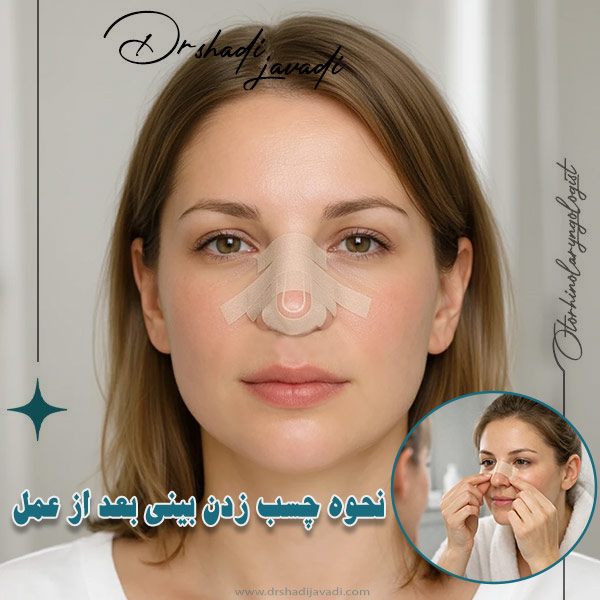 آموزش چسب زدن بینی + مزایا چسب بینی بعد از عمل